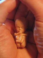 Für das Leben - Embryo Zwölf Wochen